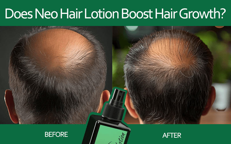 Real User Reviews: Neo Hair Lotion UK Reviews