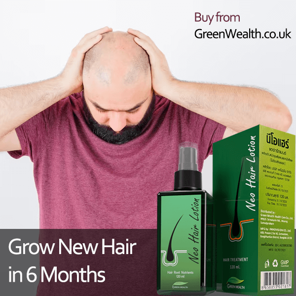 Hair treatment with neo hair lotion, grow new hair in six months