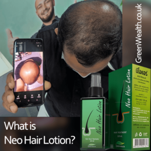 What is neo hair lotion? Introduction to green wealth neo hair lotion