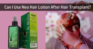 neo hair lotion